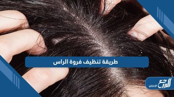 طريقة تنظيف فروة الراس؛ طرق طبيعية من المنزل