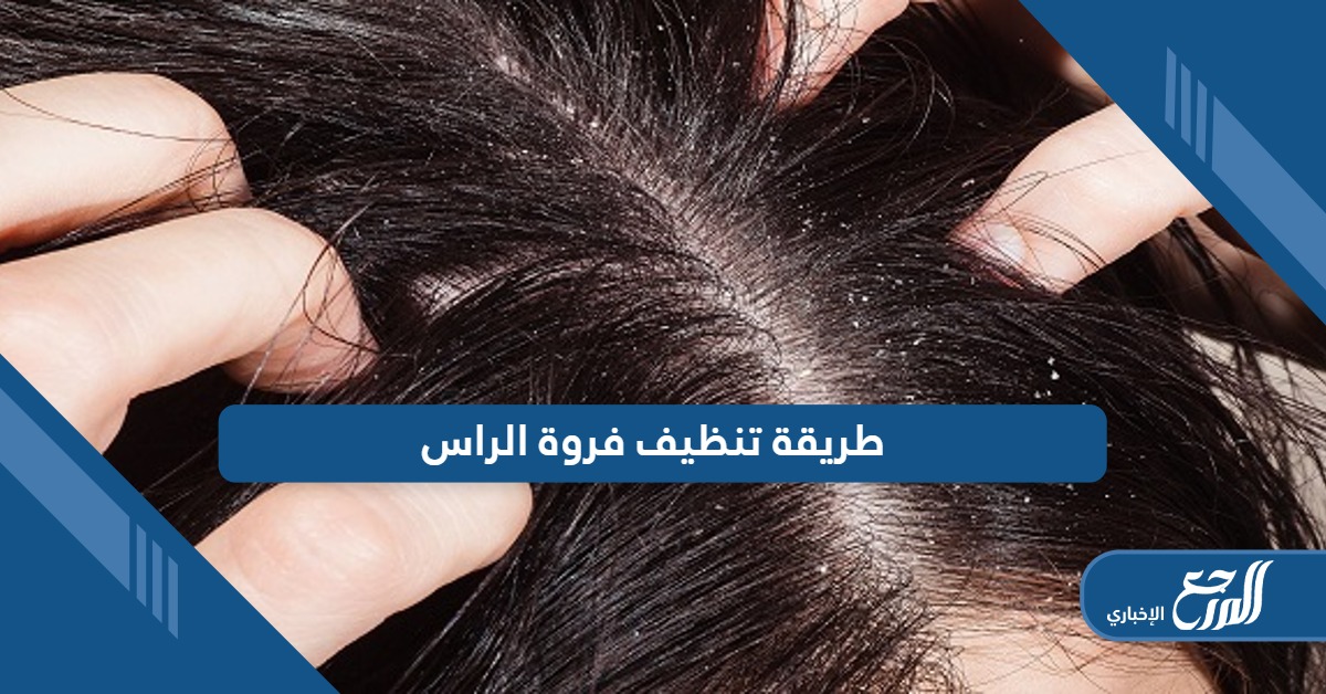 طريقة تنظيف فروة الراس؛ طرق طبيعية من المنزل