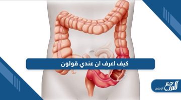 كيف اعرف ان عندي قولون؛ تعرف على أعراض القولون العصبي