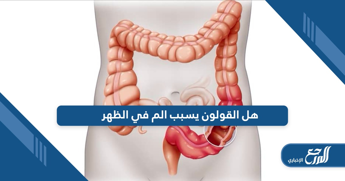 هل القولون يسبب الم في الظهر؛ الإجابة الصحيحة من هنا